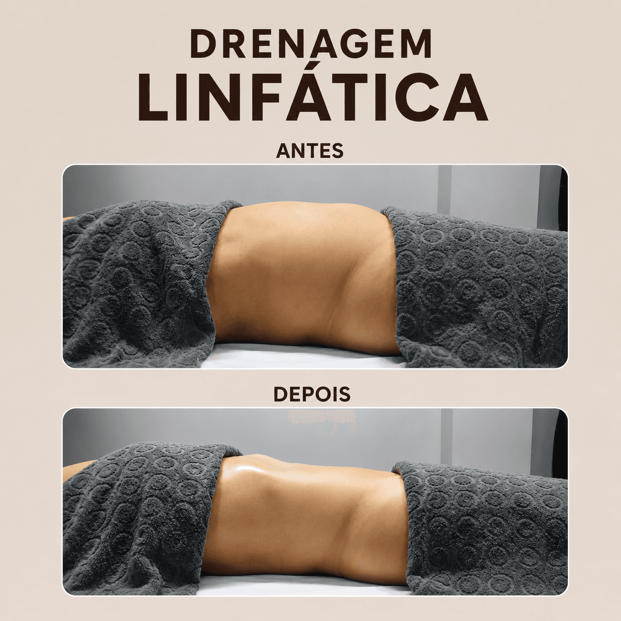 Drenagem Linfática — antes e depois na VIDEN