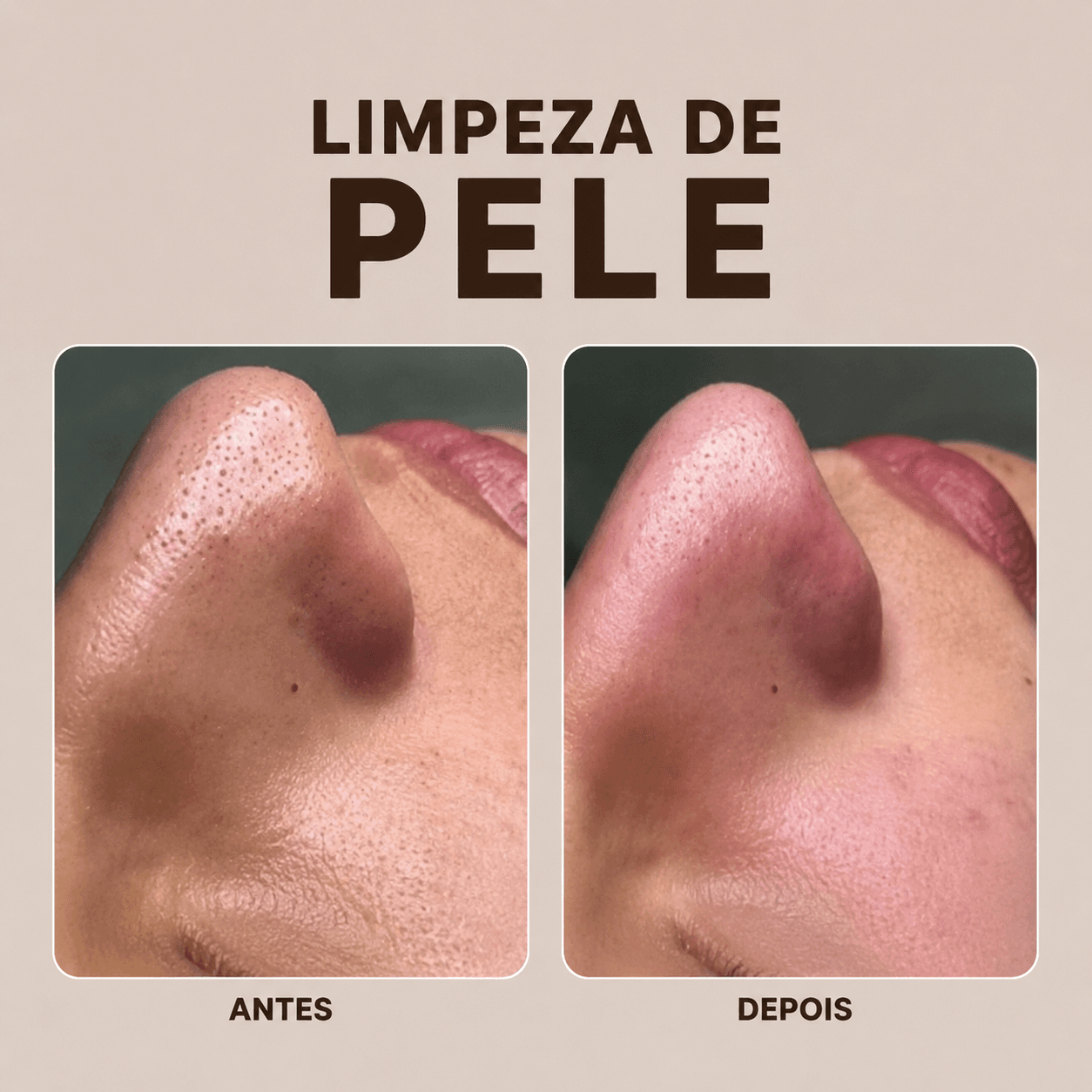 Limpeza de Pele — antes e depois na VIDEN
